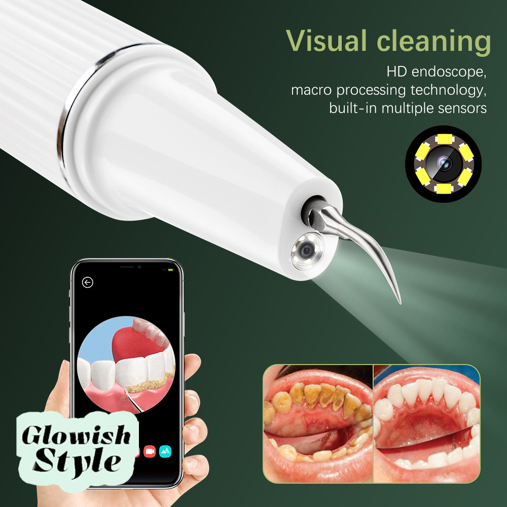 درمانش جرم گیر خانگی گلویش استایل مدل دوربین دار تجهیزات دندانپزشکی